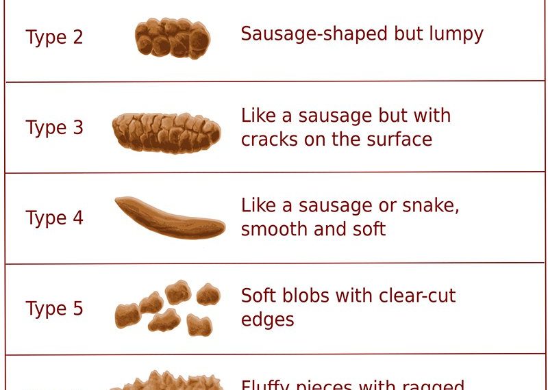 Bristol stool chart + Doc Schmidt